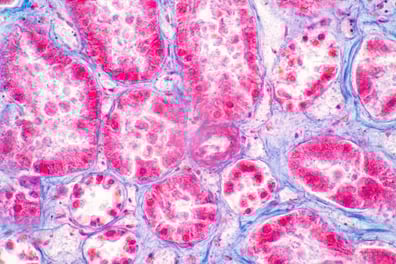 en-tête de réactivité croisée des tissus